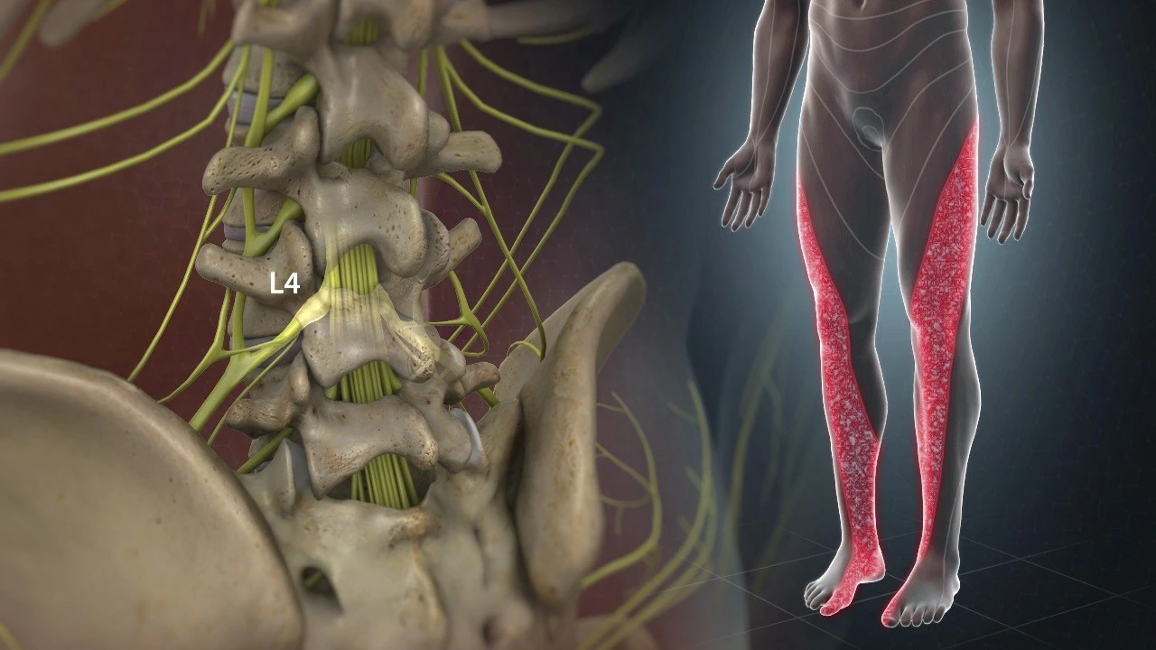 Right-leg-sciatica
