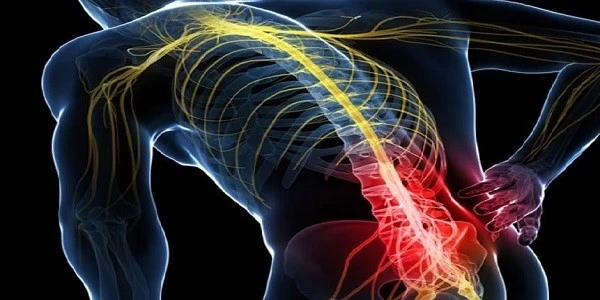 Symptoms-sciatica